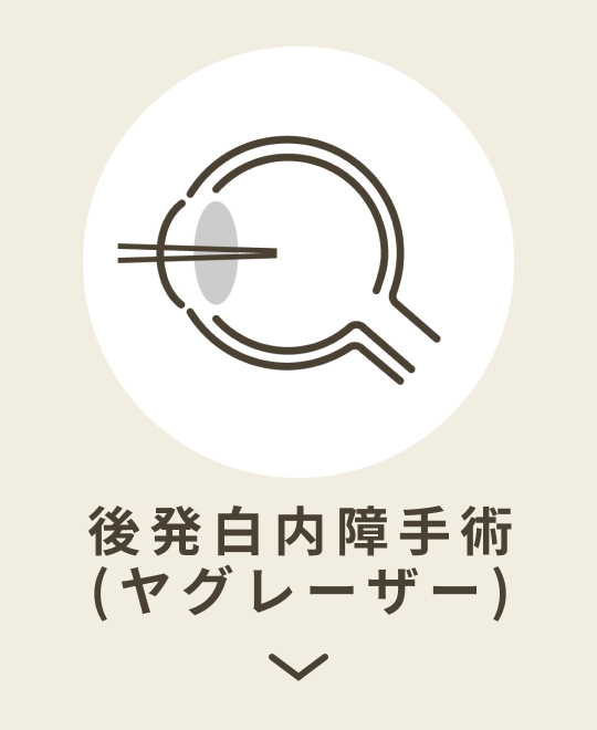 後発白内障手術
(ヤグレーザー)