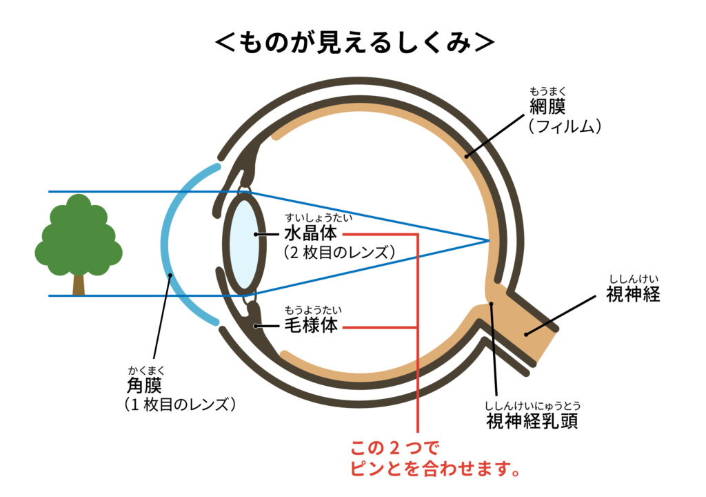 美川眼科の白内障手術